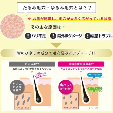 美容液 30ml ケアナボーテ 毛穴肌 エイジングケア 特濃 MC