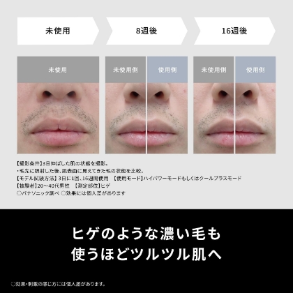 パナソニック 光エステ スムースエピ パワー&クール 光脱毛器 (フラッシュ式) ES-WG0B-H [グレー]