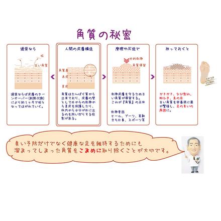 ののじ 角質こそぎ めっちゃトレ K-H01 角質こそぎ ステンレス