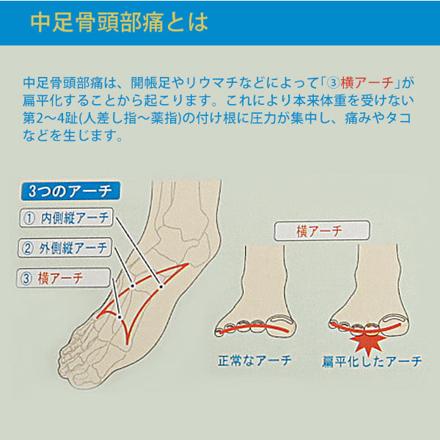 インソールプロ inSoLe PRO 中足骨頭部痛対策 インソール 中足骨頭部痛 婦人用M（23.0～23.5cM）