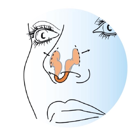 いびきヘルパー2個組 鼻腔拡張