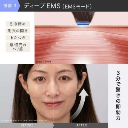 美顔器 創通メディカル MYTREX MiRAY ONE MT-MRO-24W [ホワイト]