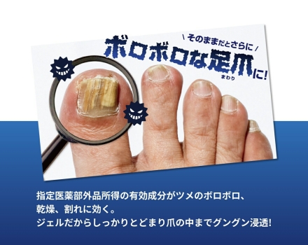 薬用足爪ジェル